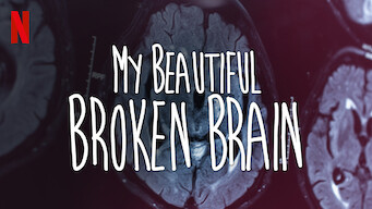 My Beautiful Broken Brain (2016)